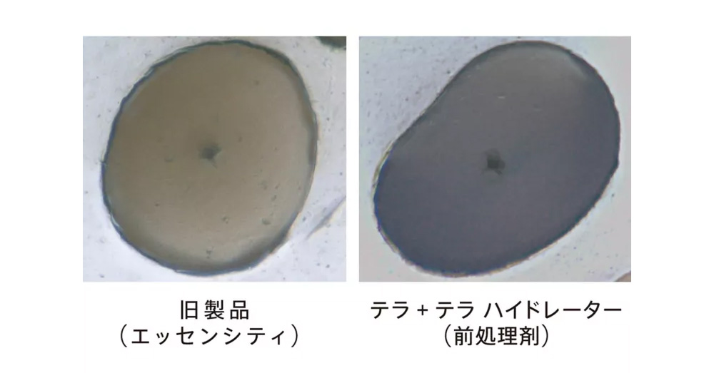 シュワルツコフ　テラ　テラとは