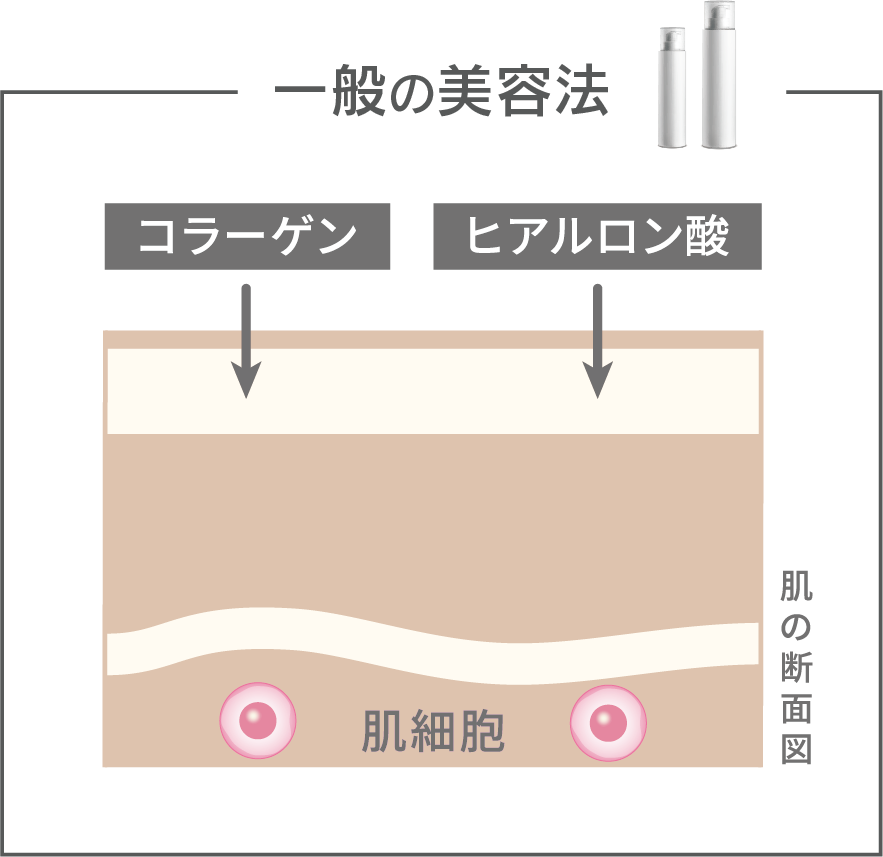 ダーウィン　リジェニティ FK クリーム　バイオリプロ FK チャージ　一般の美容法　コラーゲン　ヒアルロン酸　肌細胞　肌の断面図